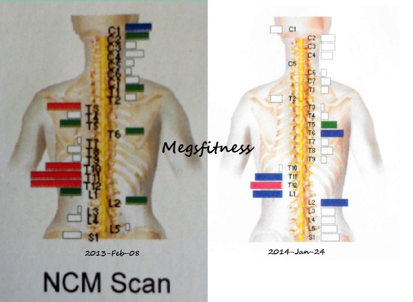 Chiropractor NCM Scan